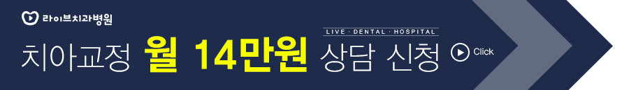 치아교정 고무줄 어렵지 않아요. (feat.영상설명) 관련 이미지 8