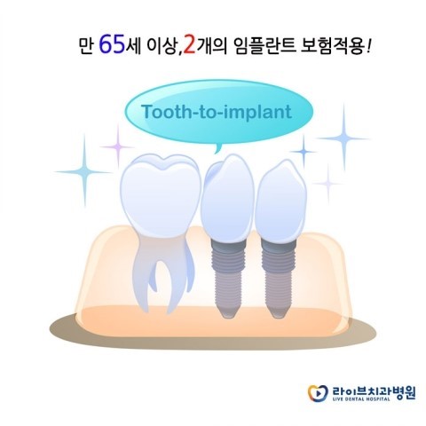임플란트보험, 부담은 줄이고 만족은 높여요! 관련 이미지 3