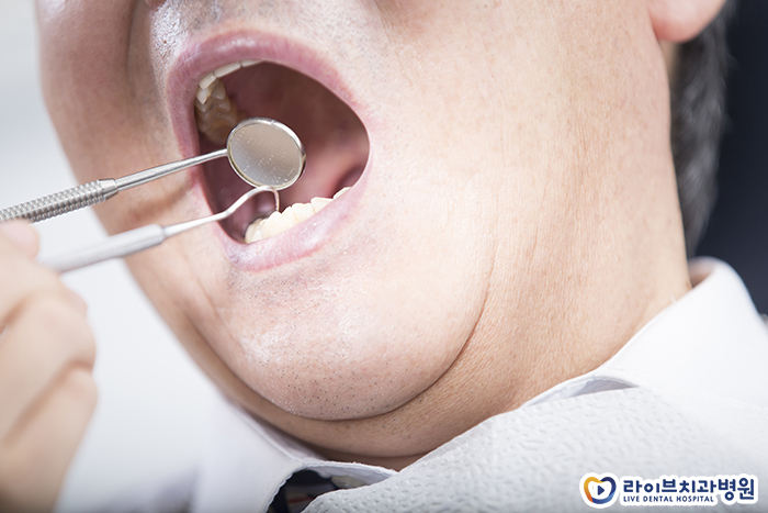 입천장 데였을때 어떻게 하죠 관련 이미지 3