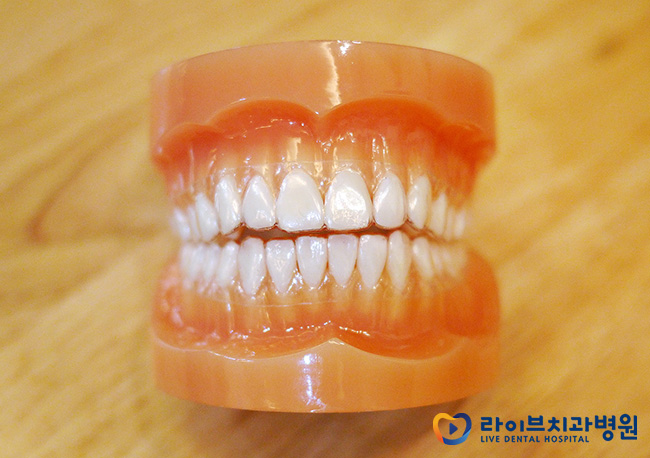 투명교정비용, 저렴하기만 하면 오케이? 관련 이미지 3