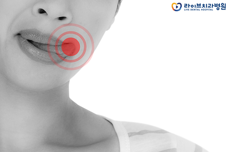 혀 깨물었을때 어떻게 해야할까 관련 이미지 2