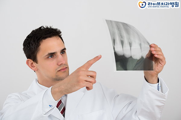 임플란트잘하는치과 신중하게 시작하자 관련 이미지 3