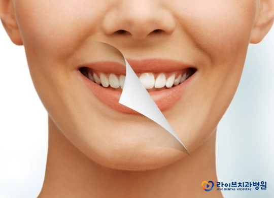 치아교정전후, 얼마나 달라질 수 있을까? 관련 이미지 3