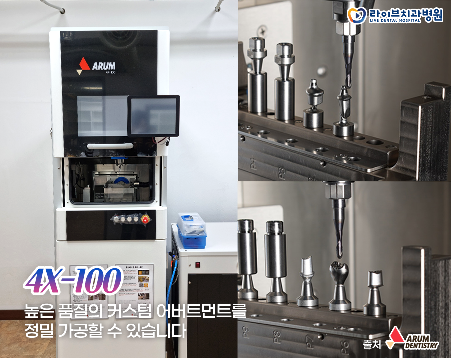 라이브치과 인천기공실에 도입된 ★NEW★기공 장비! 관련 이미지 2