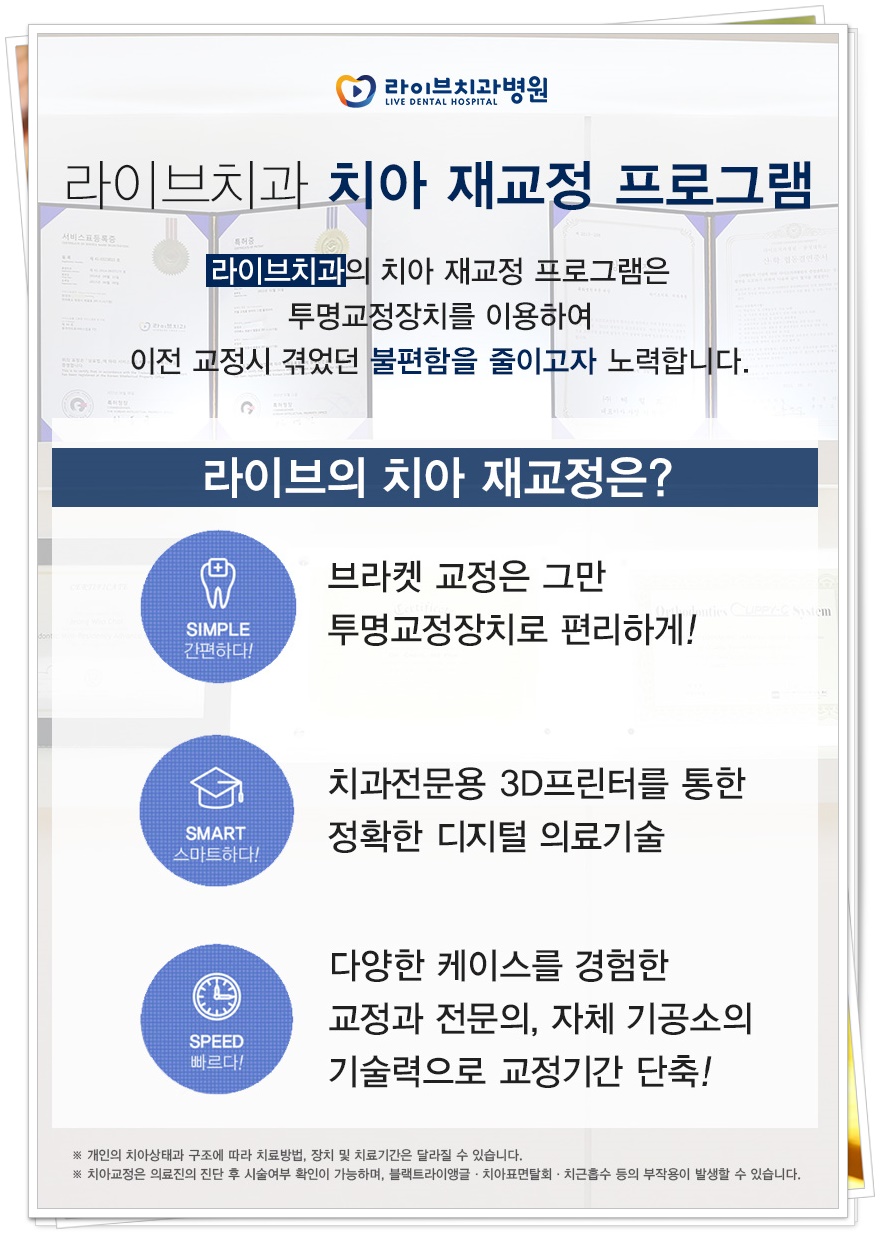 치아교정기 종류 원하는 목적에 맞게 관련 이미지 6