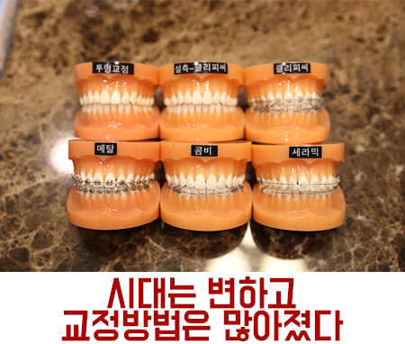 메탈교정, 튼튼하고 저렴하지만...?! 관련 이미지 5