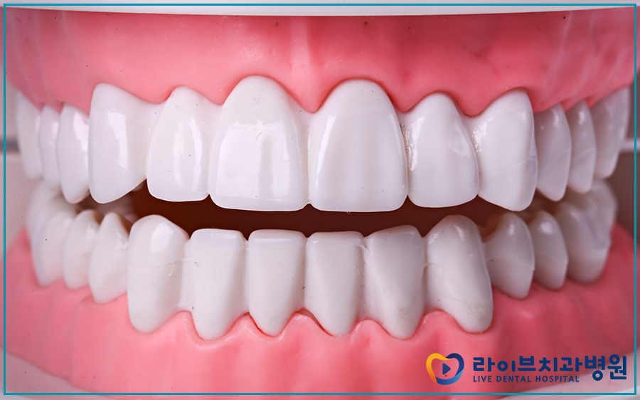 성인치아교정 제대로 알아보자! 관련 이미지 2