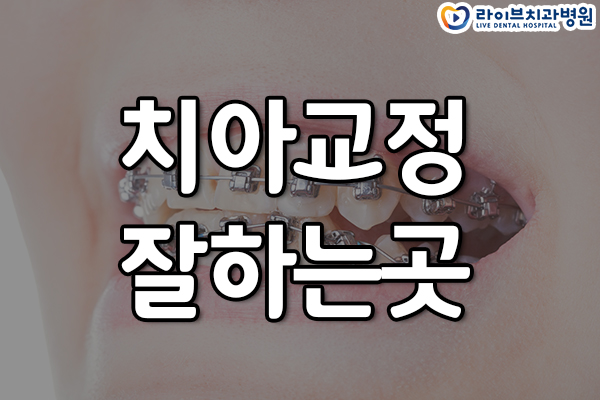 치아교정잘하는곳 처음부터 신중하게 관련 이미지 1