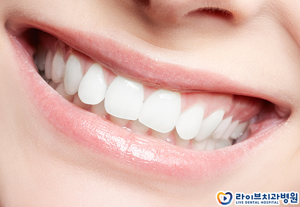 덧니교정 비용이 걱정되시나요? 관련 이미지 2