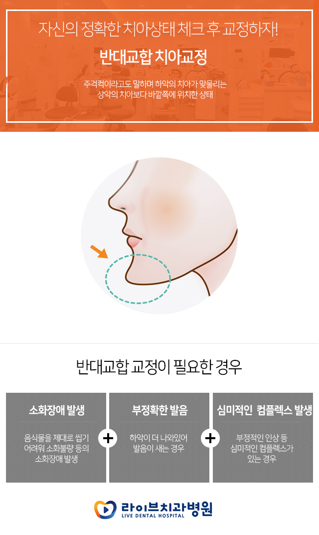 비발치교정 하나하나 알아보자~!! 관련 이미지 1