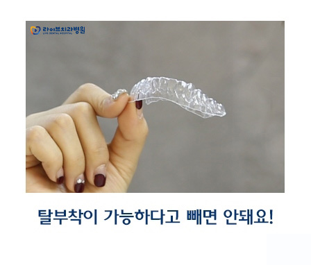 투명교정 대상과 장점은? 관련 이미지 7