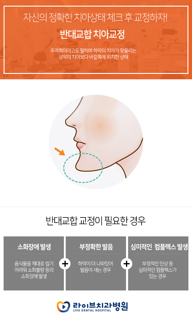 치아교정 잘하는 치과에서 계획부터 세워보자~!! 관련 이미지 1