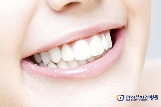 강남치아교정, 맞춤형 플랜으로 올바른 치료를! 관련 이미지 2