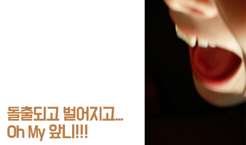 앞니교정을 알아볼까나? 관련 이미지 3