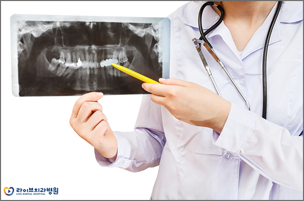 임플란트뼈이식 필요한 이유를 알아보자! 관련 이미지 3