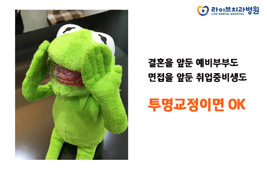 투명교정, 예비신부도 취준생도 오케이! 관련 이미지 4