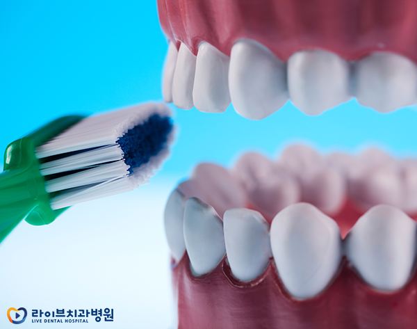 앞니교정 부담없이 받기 위해선? 관련 이미지 3