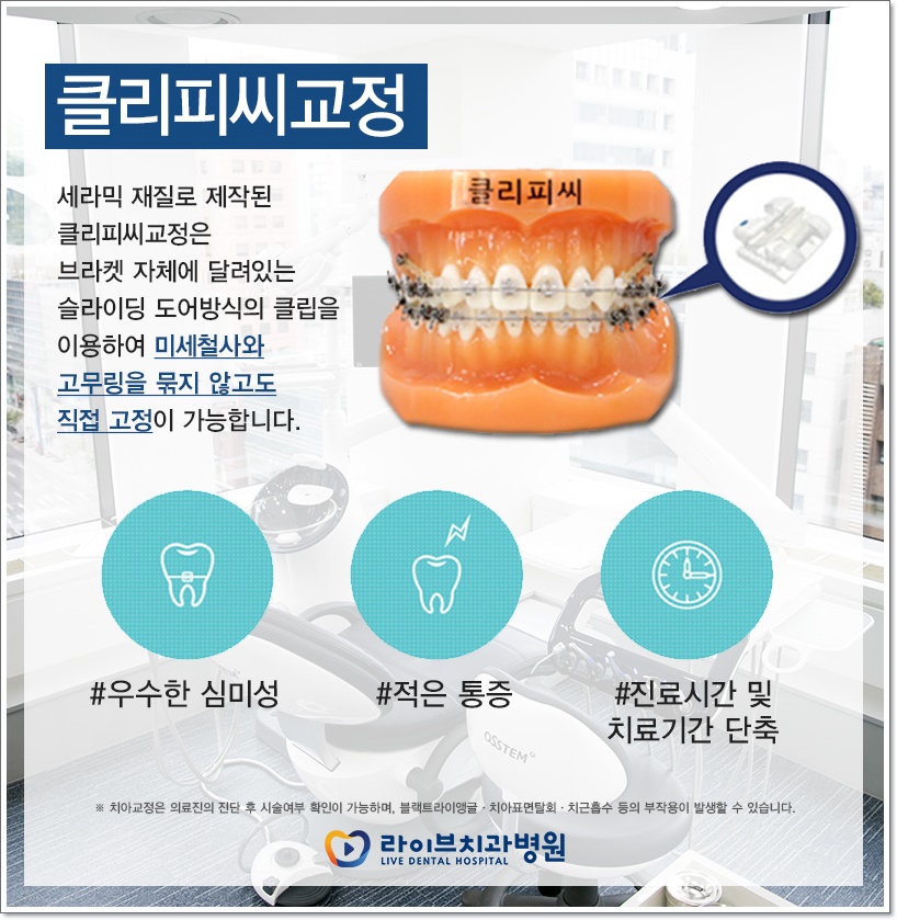 치아교정비용 종류에 따라서 관련 이미지 4