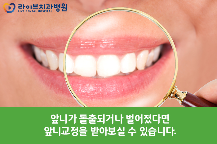 앞니교정, 부담없이 부분적으로 개선해보자 관련 이미지 2