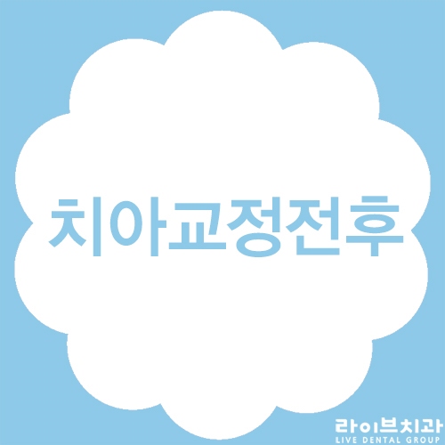 치아교정전후 만족이 높은 라이브치과병원 관련 이미지 1