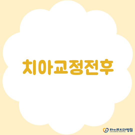 치아교정전후, 올바른 결과 도출을 위하여 관련 이미지 1