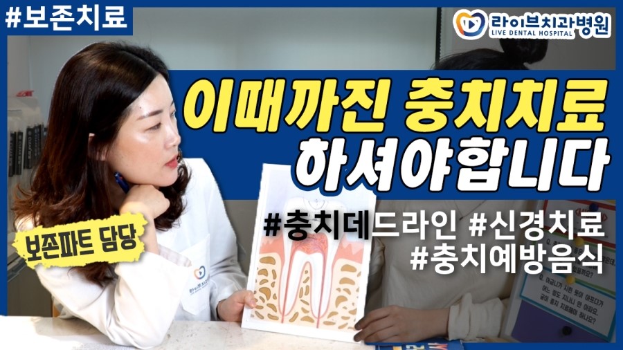 충치치료 시기를 놓치면 어떻게 되나요?! [응답하라치과의사 보존치료편] 관련 이미지 1