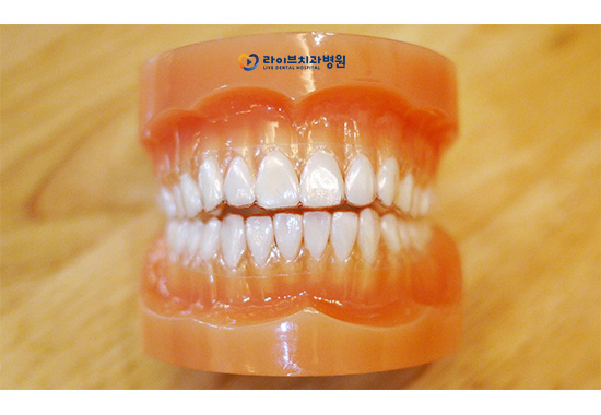 투명교정비용, 합리적으로 찾는 미소 관련 이미지 2