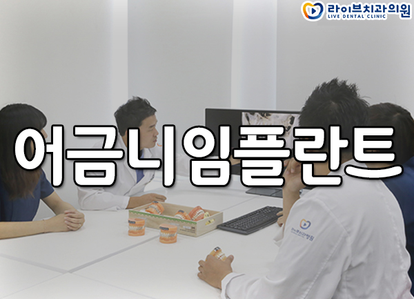어금니임플란트 망설이지 마세요! 관련 이미지 1