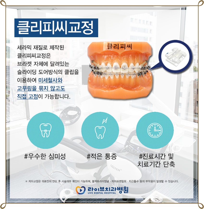 치아교정장치종류 알맞게 교정받자! 관련 이미지 2