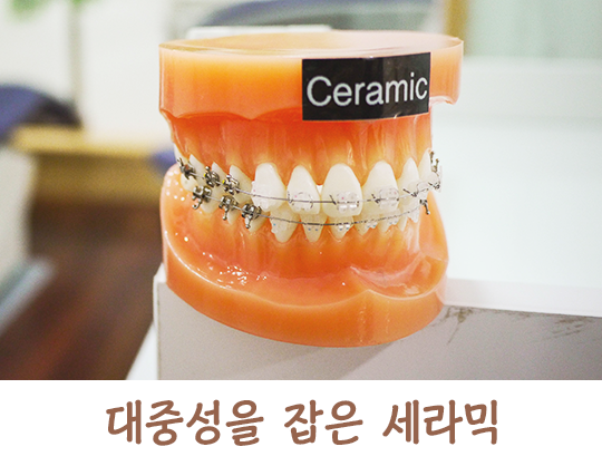 교정기의 종류에 대해 알아보자! 관련 이미지 3