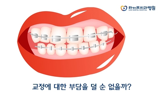 투명교정 대상과 장점은? 관련 이미지 2
