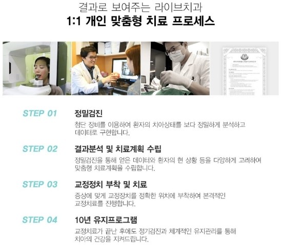 덧니교정 알아보고 계신가요? 관련 이미지 4