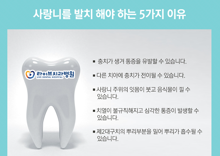 매복사랑니 발치 신중하게 받자 관련 이미지 3