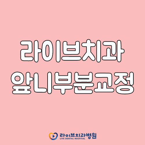 앞니부분교정, 어떤 케이스에 적합할까? 관련 이미지 1