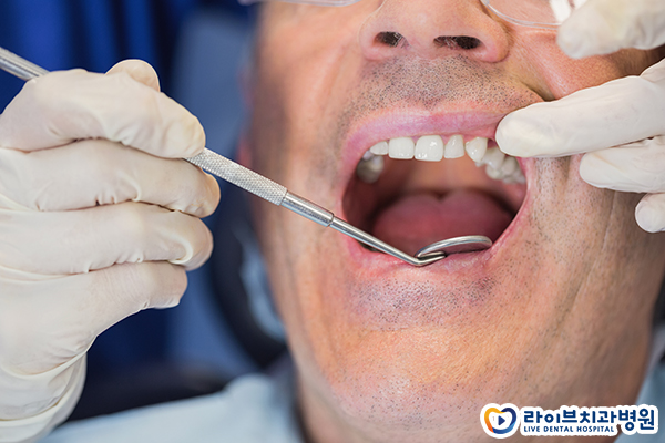 임플란트잘하는치과 신중하게 시작하자 관련 이미지 5