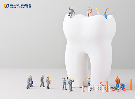 투명하고 안전한 라이브 임플란트FAQ 1편 관련 이미지 2