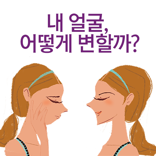 치아교정 얼굴변화, 변화의 정도는? 관련 이미지 2