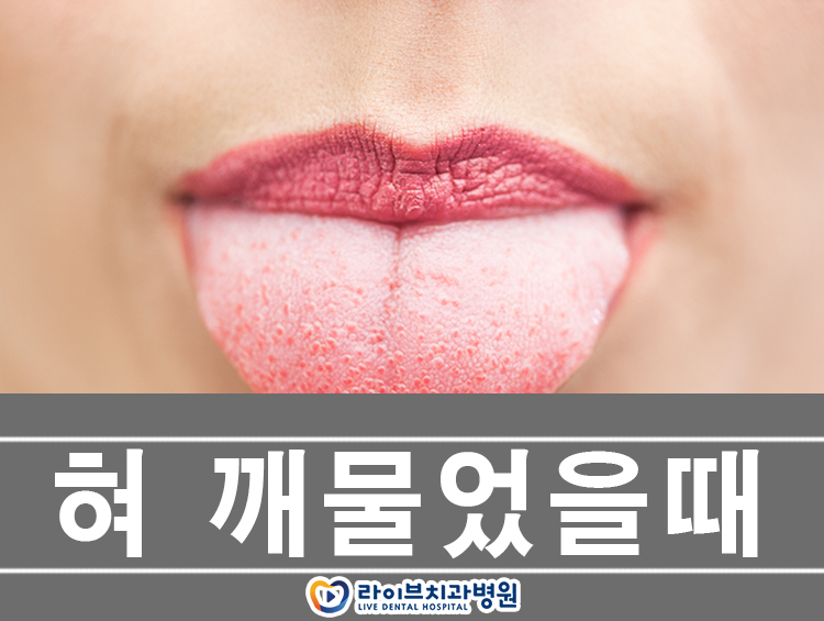 혀 깨물었을때 어떻게 해야할까 관련 이미지 1