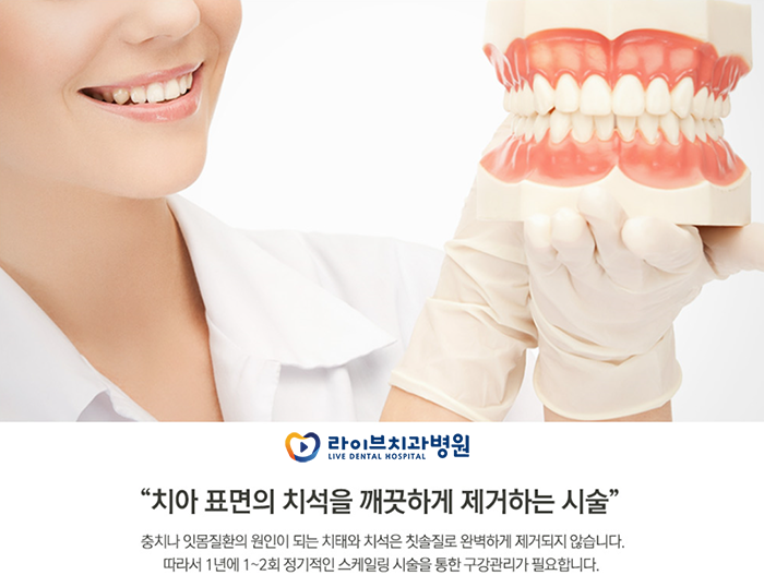 스케일링 보험적용 몇 번 되나요? 관련 이미지 2