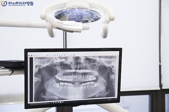 오스템임플란트 어떤 재료인지 알아보자 관련 이미지 2