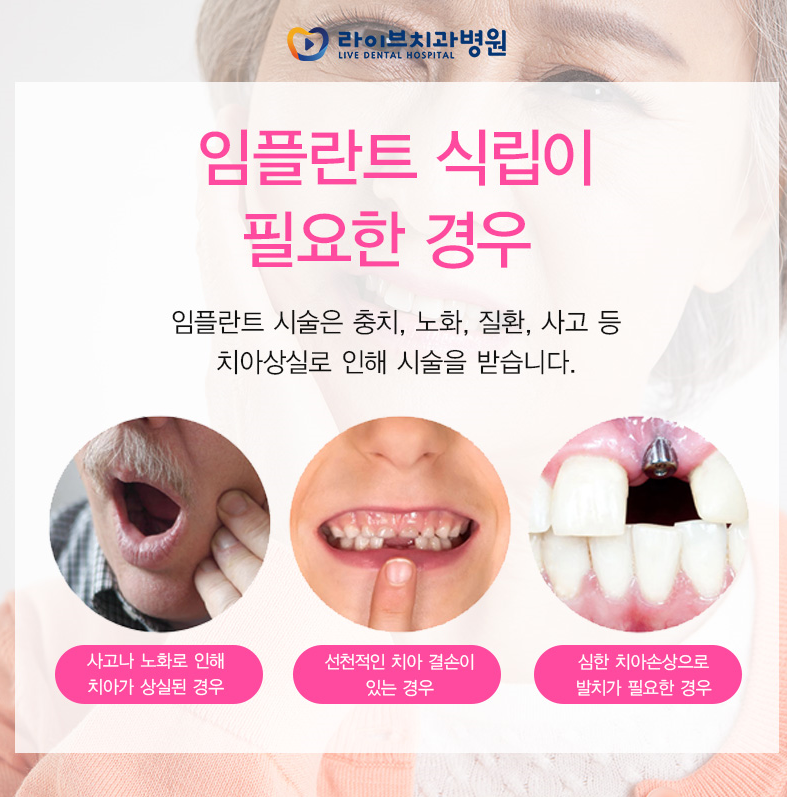 인천임플란트, 어디로 가야 할까요?? 관련 이미지 2