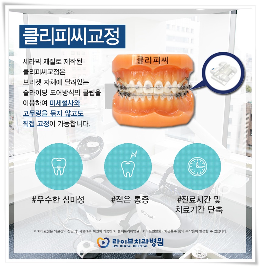 이교정으로 보기 싫은 입툭튀교정! 관련 이미지 4