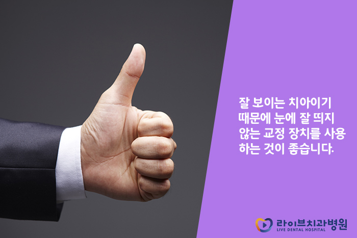 앞니교정, 부담없이 부분적으로 개선해보자 관련 이미지 5