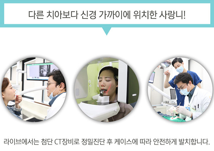 사랑니 발치 후 식사 어떻게 하지 관련 이미지 4