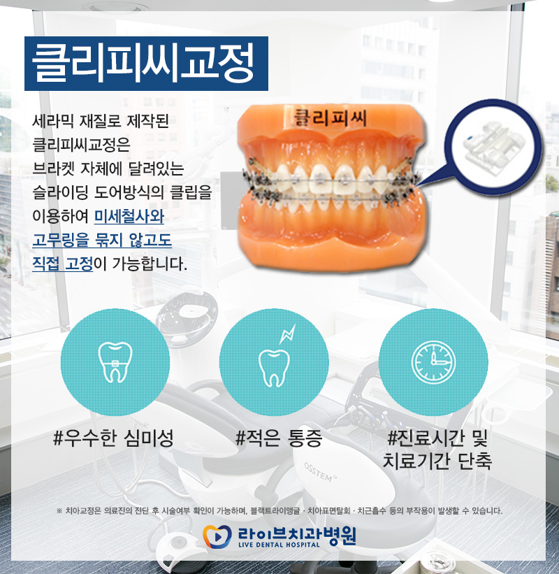 클리피씨교정 치아교정분납으로 해결!! 관련 이미지 2