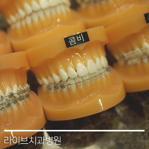 다양한 교정기의 종류들! 관련 이미지 7