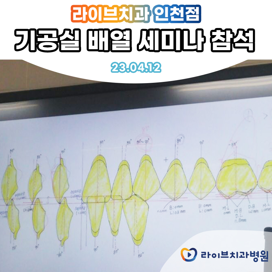 라이브치과 인천점 기공실 배열 세미나 참석! 관련 이미지 2