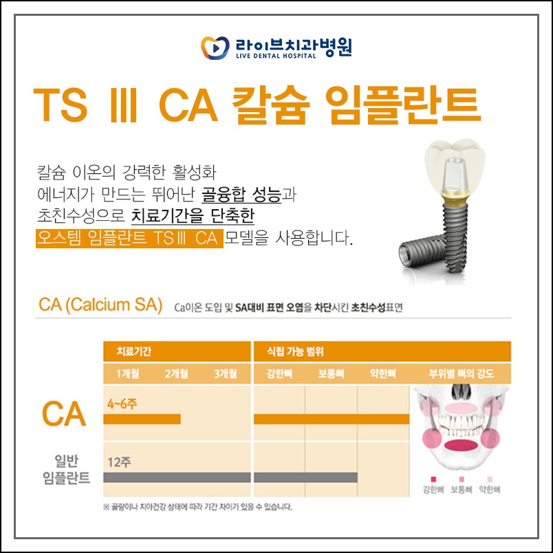 어금니임플란트 당일에 받으려면? 관련 이미지 4
