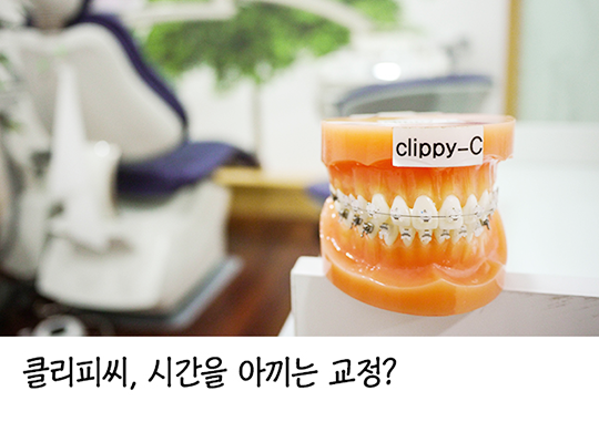 클리피씨교정, 기간 때문에 교정을 고민하시나요? 관련 이미지 5