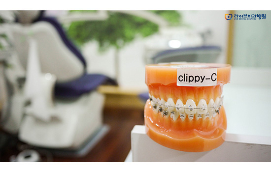치아교정, 방법과 과정은? 관련 이미지 5